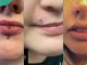 Lip piercing: a complete guide to types and what they entail