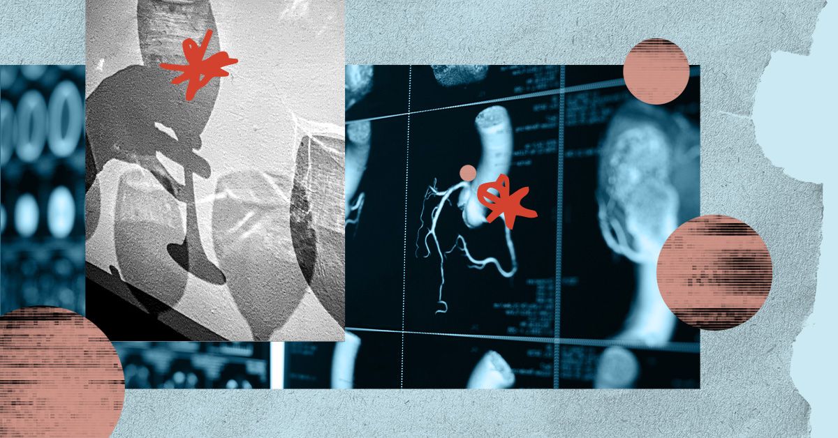 What does alcohol consumption actually do to the heart?