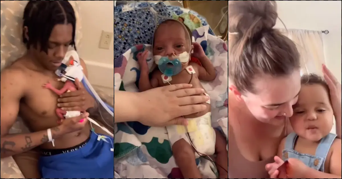 Couple shares touching transformation of their premature baby