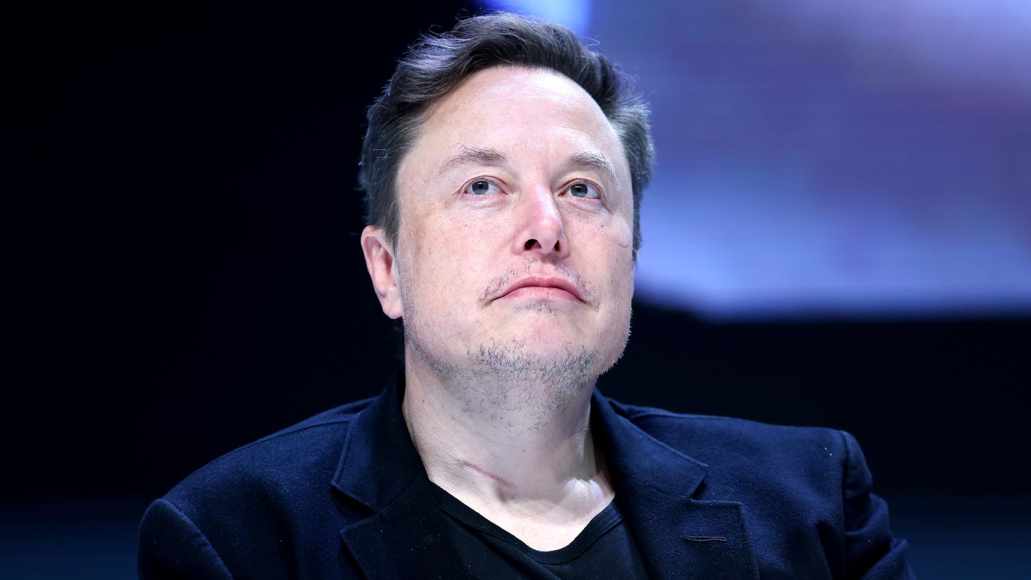 Elon Musk Claims Brain-chip Capable Of Restoring Vision To Persons Born Blind