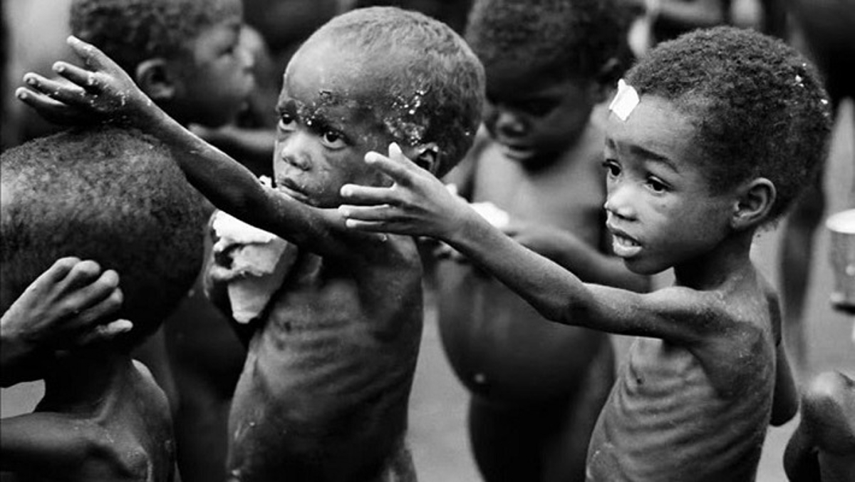 One in four children under five years malnourished in Zamfara – Report