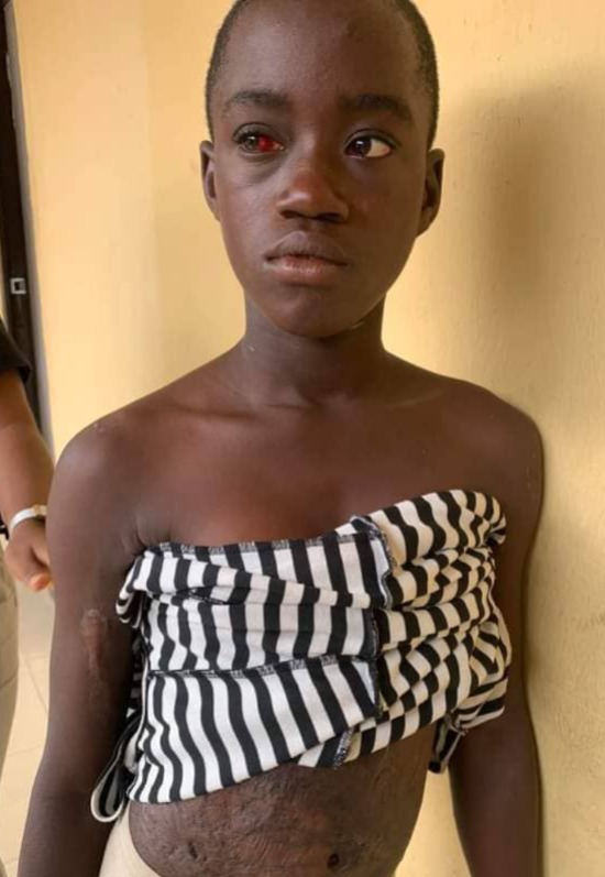 Police Arrest Woman For Battering 12-yr-old Step-daughter