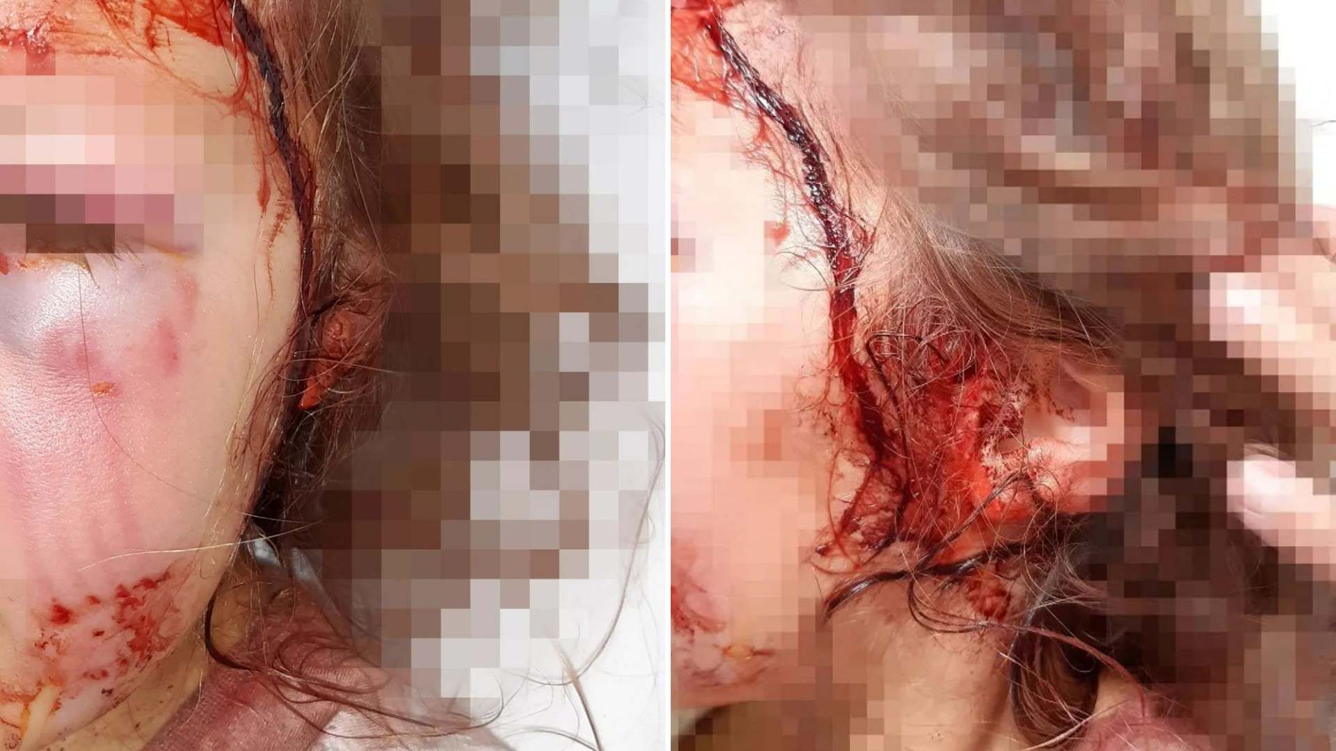 Stark warning to parents as harrowing pictures show girl covered in blood after family dog bit her HEAD in horror attack