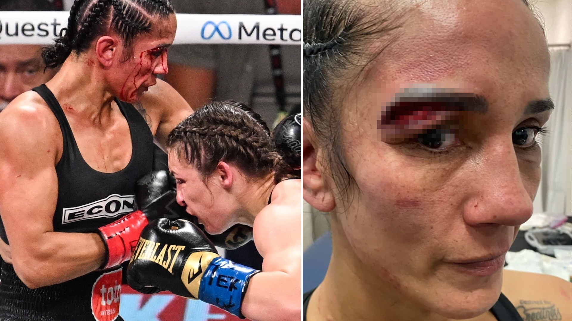 Amanda Serrano shows of gruesome gaping wound above her eye after controversial defeat to Katie Taylor