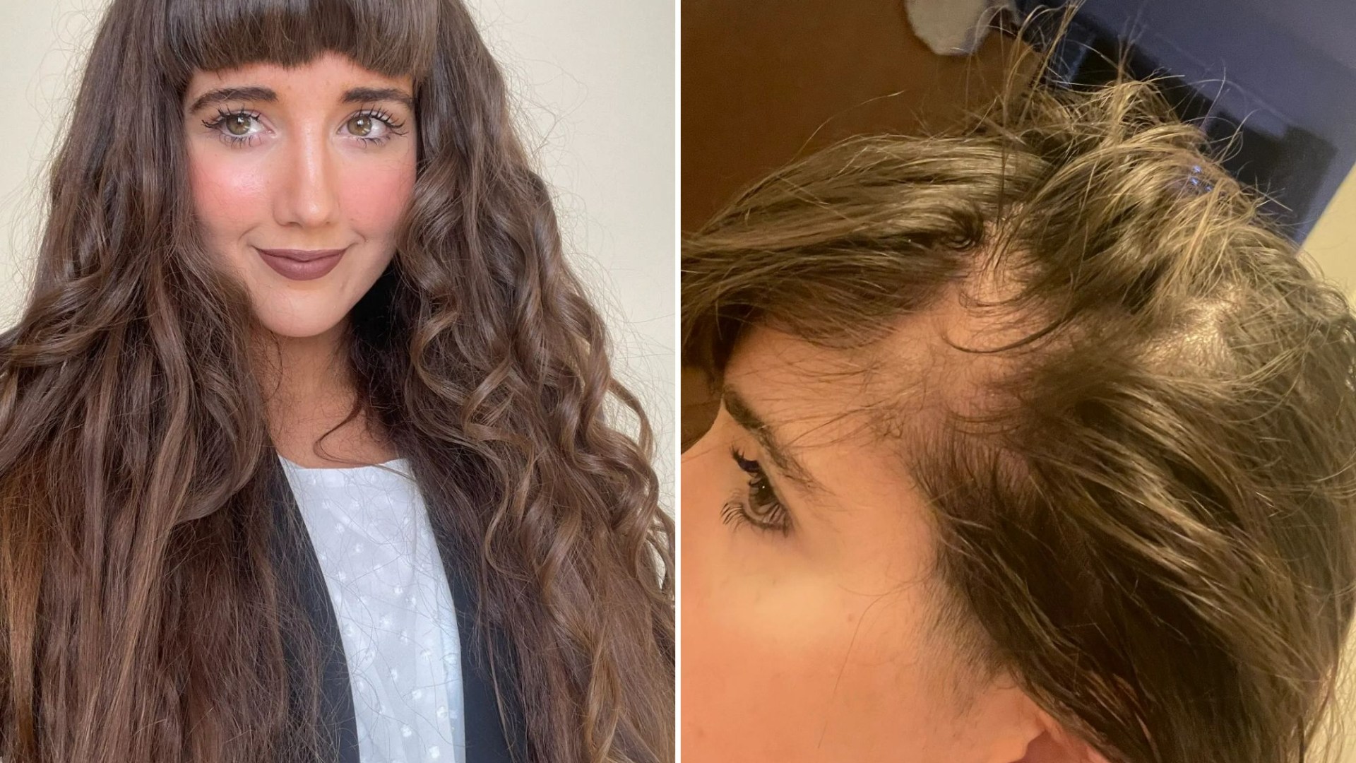 My hair was falling out so bad I had bald patches - the viral hack you need to avoid & the £15 buy that fixed it quickly