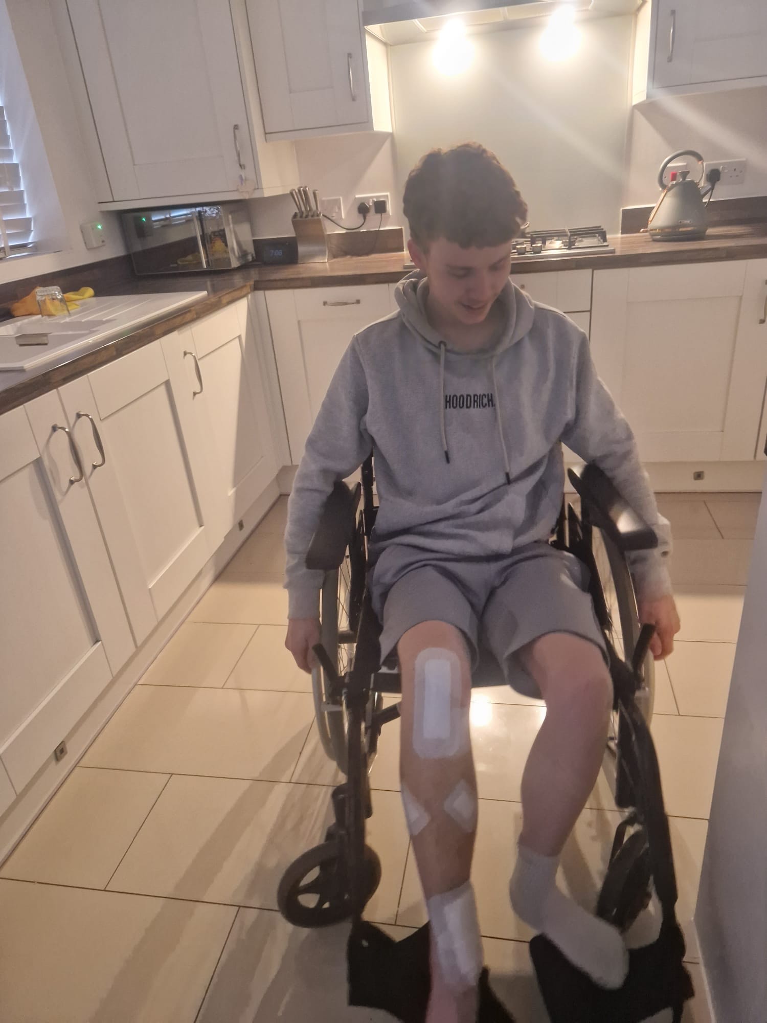 He was left with two shattered legs and unable to walk for months