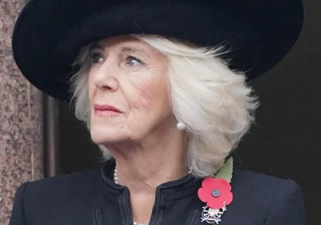 Queen Camilla To Miss Remembrance Events Over Infection