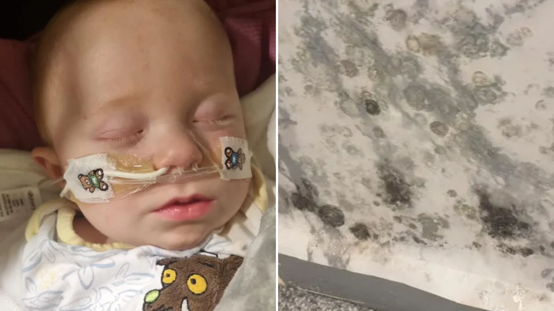 I’m sharing harrowing pics of my baby son fighting for life after mouldy flat left kids chewing on fungus-coated toys