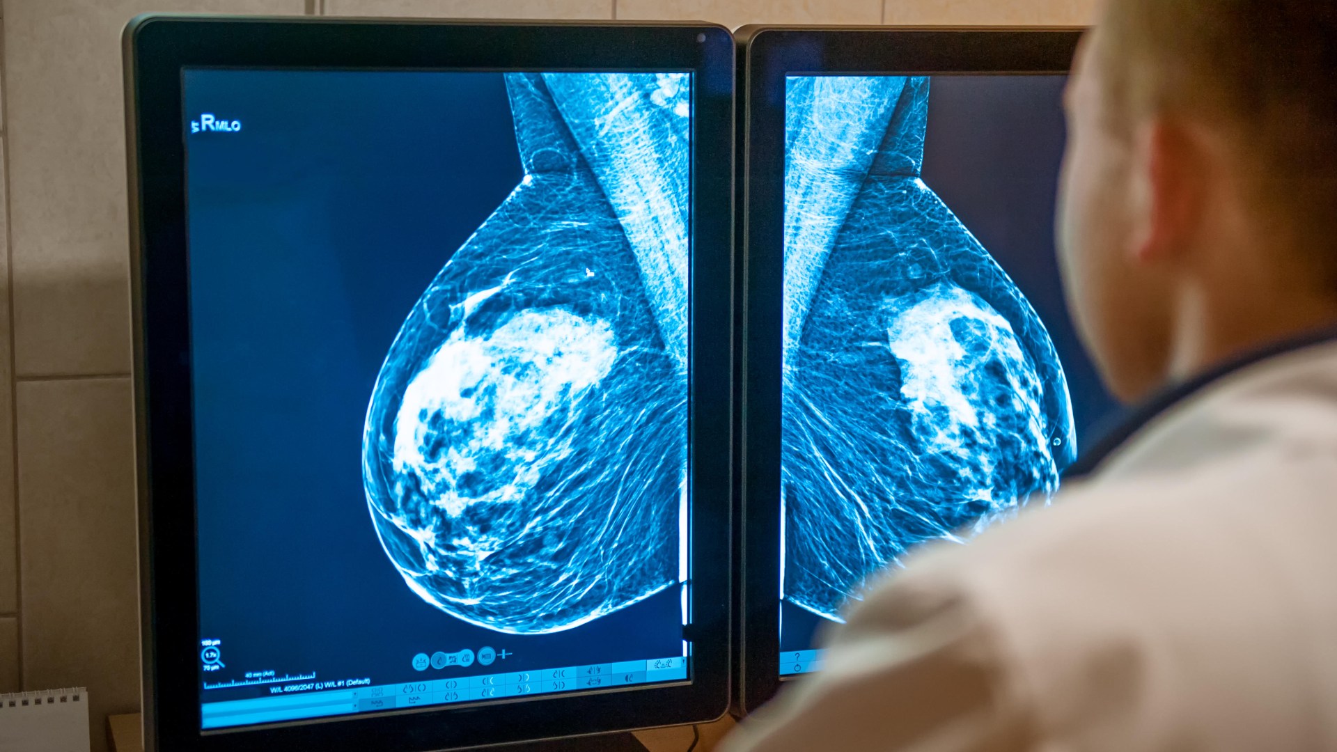 Thousands of cancer cases MISSED as Brits ignore vital invites - are you at risk?