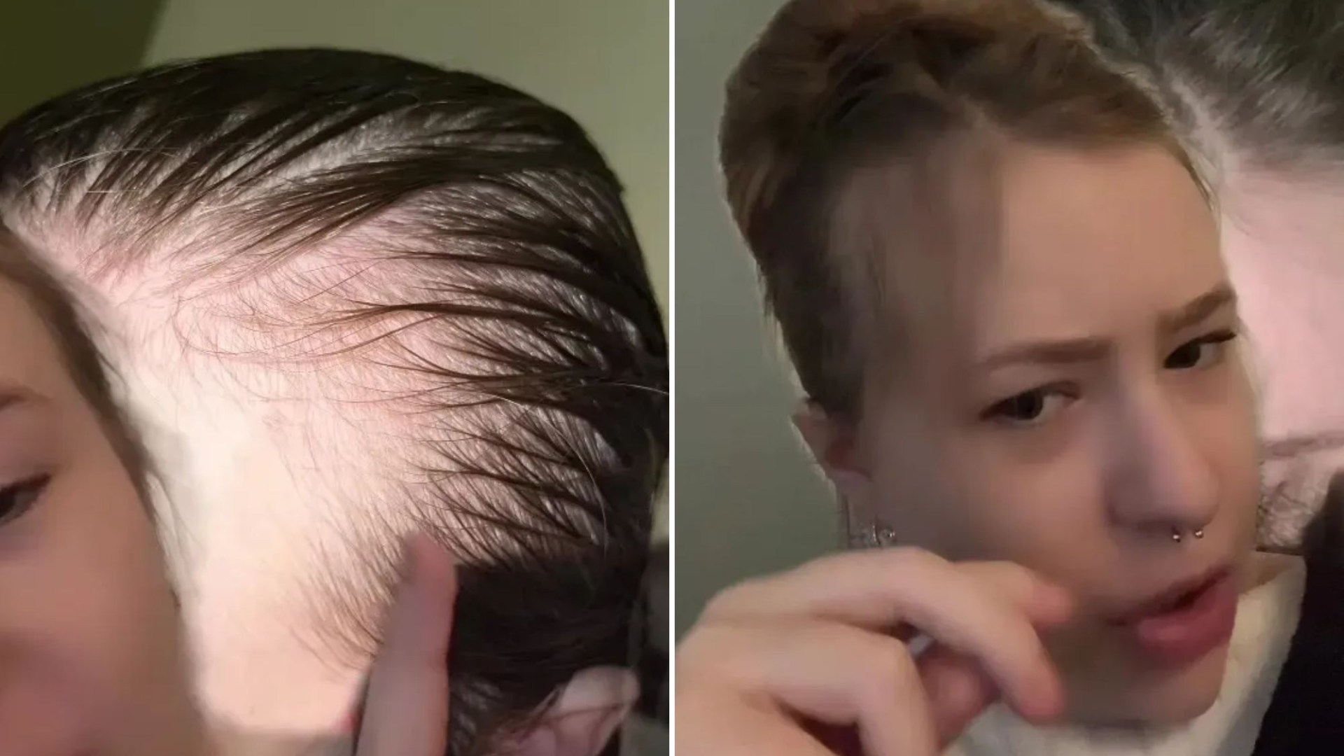 My hair was so thin and receding you could see my scalp - I found a kitchen hack that thickened it within a month