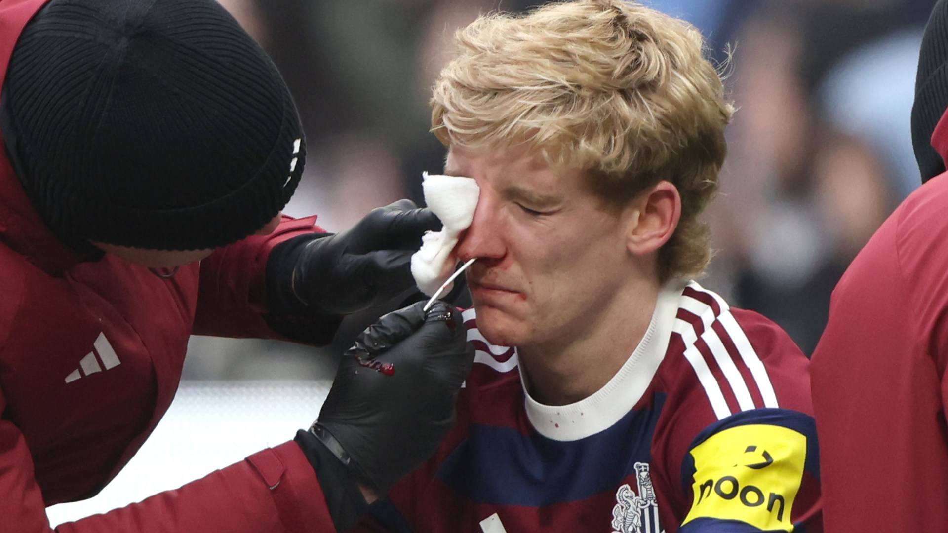 Anthony Gordon left covered in blood after he's caught in the face by Dejan Kulusevski in sickening collision