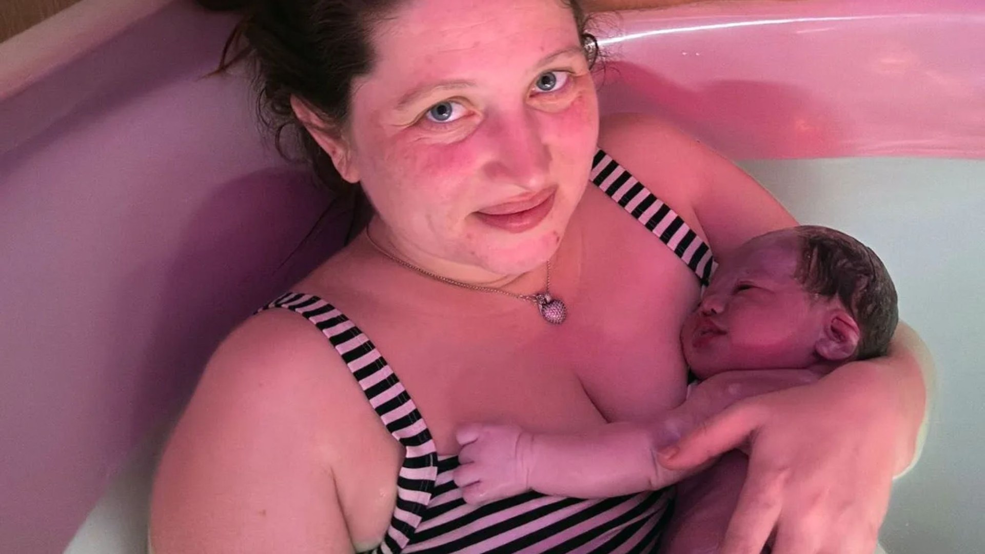 Miracle baby born through 'mermaid delivery' on New Year's Day beat one in 80,000 odds