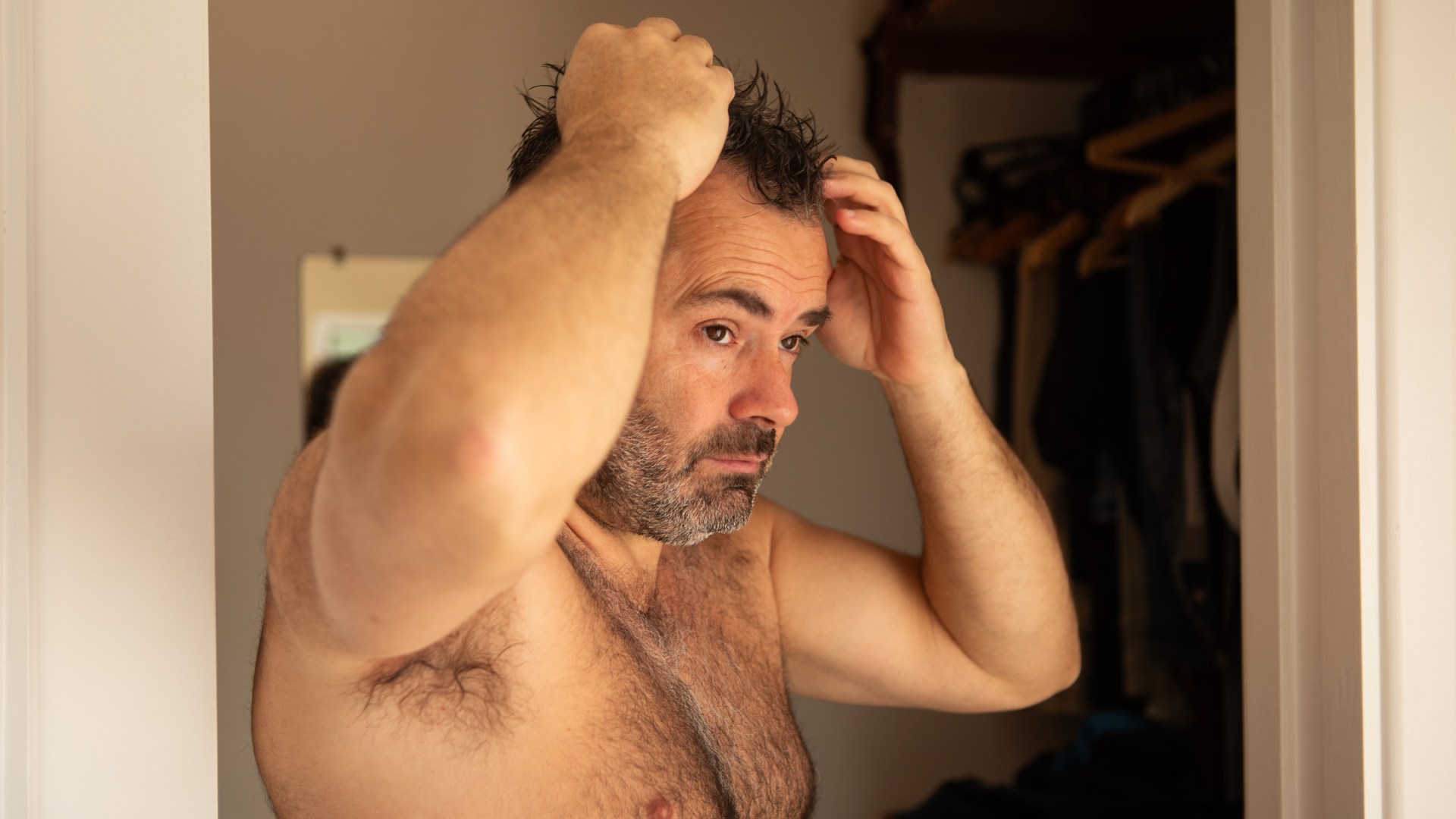 My hairy back makes me so self-conscious that I now avoid meeting women